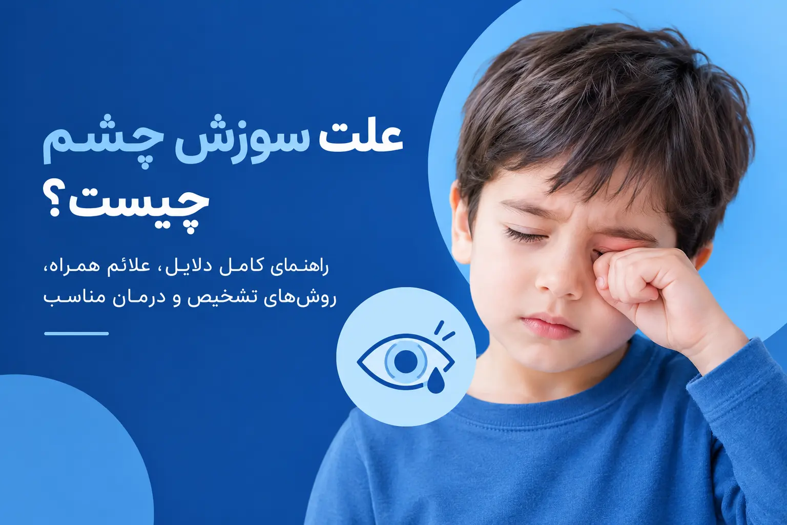 علت سوزش چشم چیست ؟